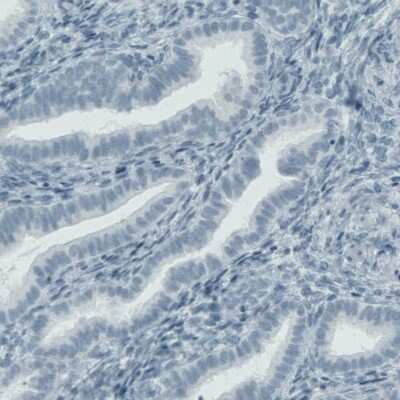 Immunohistochemistry-Paraffin: MMP-9 Antibody (CL0542) [NBP2-52950]