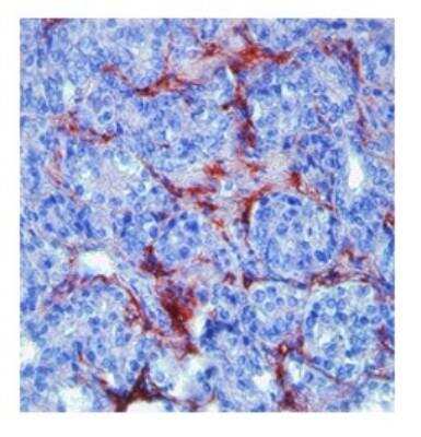 Immunohistochemistry-Paraffin: MMP-9 Antibody - BSA Free [NBP1-57940]