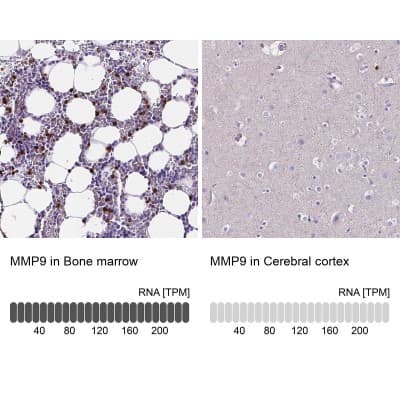 Immunohistochemistry-Paraffin: MMP-9 Antibody [NBP1-85575]