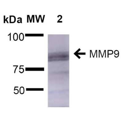 Western Blot: MMP-9 Antibody (S51-82) [NBP2-59699]