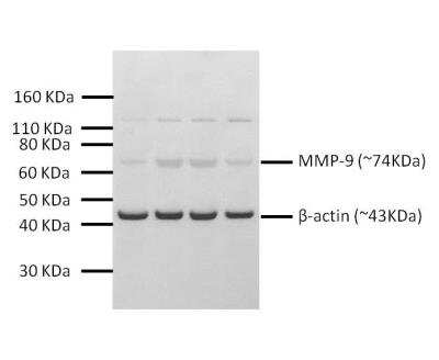 Western Blot: MMP-9 AntibodyBSA Free [NBP1-57940]