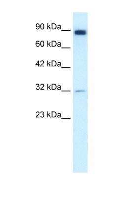 Western Blot: MMP-9 AntibodyBSA Free [NBP1-57940]