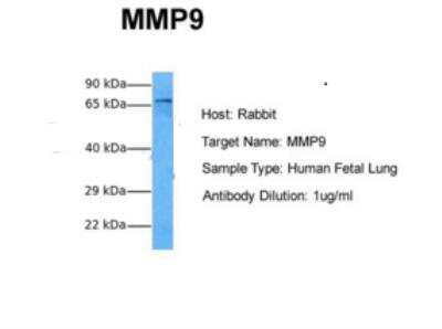 Western Blot: MMP-9 AntibodyBSA Free [NBP1-57940]