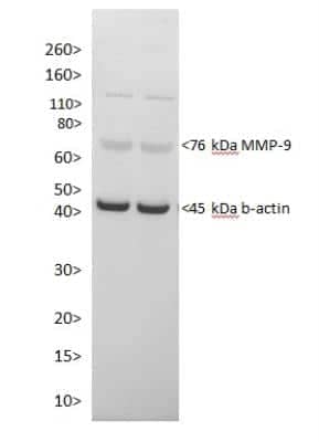 Western Blot: MMP-9 AntibodyBSA Free [NBP1-57940]