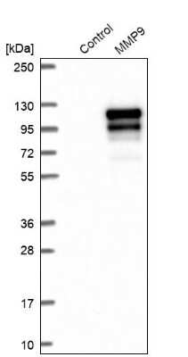 Western Blot: MMP-9 Antibody [NBP2-39011]