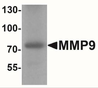 Western Blot: MMP-9 AntibodyBSA Free [NBP2-41233]