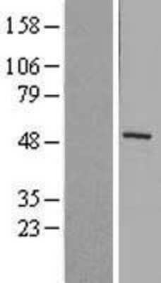 Western Blot: MMP-1 Overexpression Lysate [NBL1-13149]