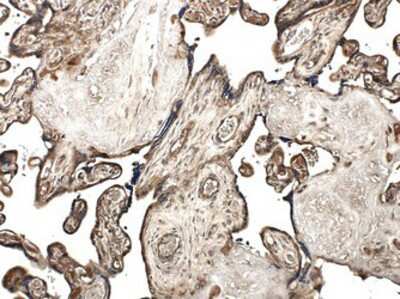 Immunohistochemistry-Paraffin: MMP-10 Antibody (MM0024-9G10) - Azide and BSA Free [NB110-60990]