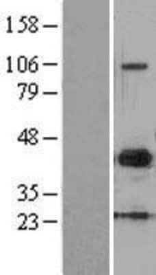 Western Blot: MMP-10 Overexpression Lysate [NBL1-13150]