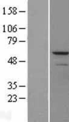 Western Blot: MMP-13 Overexpression Lysate [NBL1-13152]