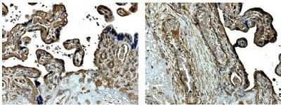 Immunohistochemistry-Paraffin: MMP-14/MT1-MMP Antibody (MM0027-9E10) - Azide and BSA Free [NB110-60993]