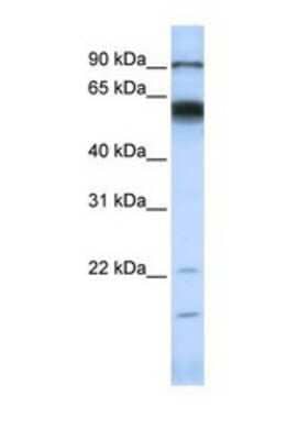 Western Blot: MMP-16/MT3-MMP Antibody [NBP1-69349]