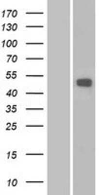 Western Blot: MMP-16/MT3-MMP Overexpression Lysate [NBP2-06425]