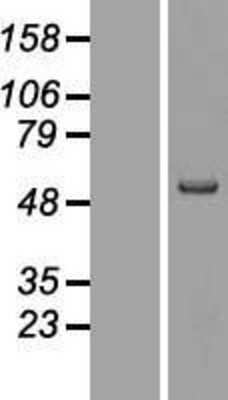 Western Blot: MMP-19 Overexpression Lysate [NBL1-13155]