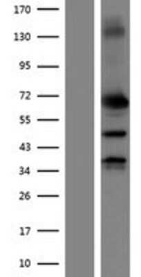 Western Blot: MMP-2 Overexpression Lysate [NBP2-07861]