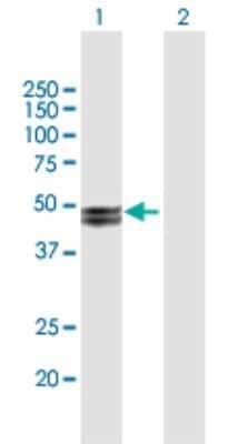 Western Blot: MMP20 Antibody [H00009313-B01P]