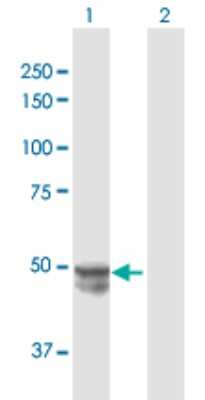 Western Blot: MMP20 Antibody [H00009313-D01P]