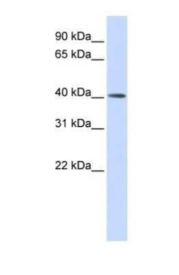 Western Blot: MMP20 Antibody [NBP1-62322]