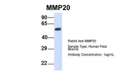 Western Blot: MMP20 Antibody [NBP1-62322]