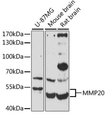 Western Blot: MMP20 AntibodyAzide and BSA Free [NBP3-04392]