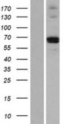 Western Blot: MMP21 Overexpression Lysate [NBP2-05438]