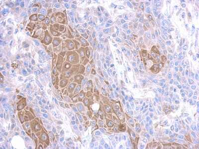 Immunohistochemistry-Paraffin: MMP23B Antibody [NBP2-17313]