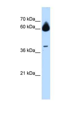 Western Blot: MMP23B Antibody [NBP1-59459]