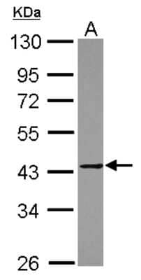 Western Blot: MMP23B Antibody [NBP2-17313]