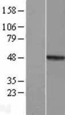 Western Blot: MMP23B Overexpression Lysate [NBL1-13157]