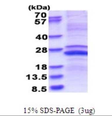 SDS-PAGE: Recombinant Human MMP23B His Protein [NBP2-51673]