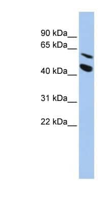 Western Blot: MMP-24/MT5-MMP Antibody [NBP1-59458]