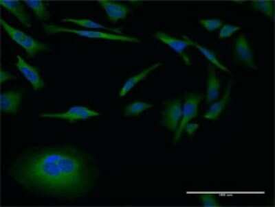 Immunocytochemistry/ Immunofluorescence: MMP26 Antibody (3B9) [H00056547-M02]