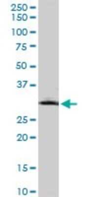 Western Blot: MMP26 Antibody (6C6) [H00056547-M01]