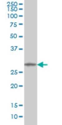 Western Blot: MMP26 Antibody (6C6) [H00056547-M01]