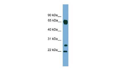 Western Blot: MMP26 Antibody [NBP2-86707]