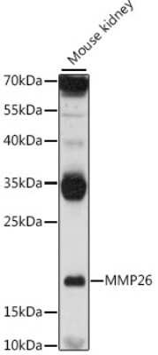 Western Blot: MMP26 AntibodyAzide and BSA Free [NBP3-05179]