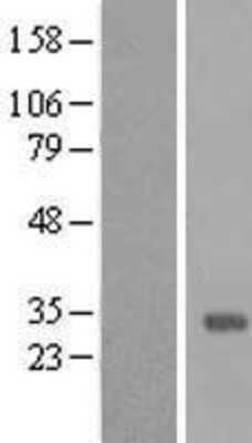 Western Blot: MMP26 Overexpression Lysate [NBL1-13158]