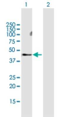 Western Blot: MMP28 Antibody [H00079148-B01P]