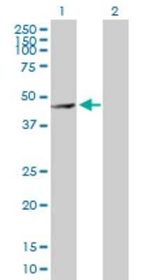 Western Blot: MMP28 Antibody [H00079148-D01P]