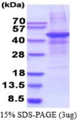 SDS-PAGE: Recombinant Human MMP28 His Protein [NBP2-51562]