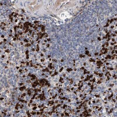 Immunohistochemistry-Paraffin: MMP-8 Antibody [NBP1-85576]