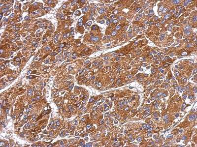 Immunohistochemistry-Paraffin: MMP-8 Antibody [NBP2-17316]