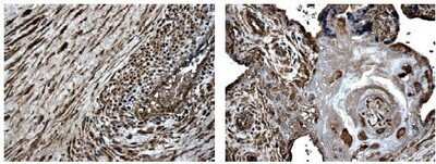 Immunohistochemistry-Paraffin: MMP-8 Antibody (MM0023-7A11) - Azide and BSA Free [NB110-60989]