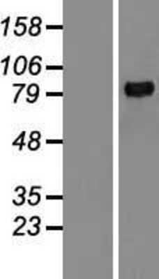 Western Blot: MMP-9 Overexpression Lysate [NBL1-13162]