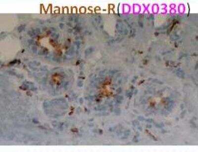 Immunohistochemistry-Paraffin: MMR/CD206/Mannose Receptor Antibody (122D2.08) [DDX0380P-100]