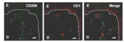 In-situ Hybridization: MMR/CD206/Mannose Receptor Antibody (122D2.08) [DDX0380P-100]