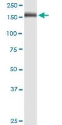 Western Blot: MMR/CD206/Mannose Receptor Antibody (5C11) [H00004360-M02]