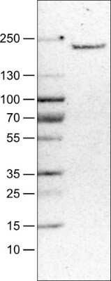 Western Blot: MMR/CD206/Mannose Receptor Antibody (CL0387) [NBP2-52927]
