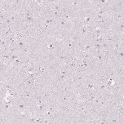 Immunohistochemistry-Paraffin: MMR/CD206/Mannose Receptor Antibody [NBP1-90020]