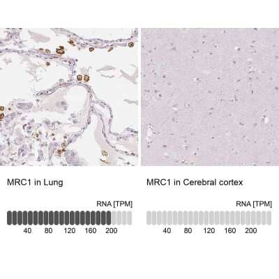 Immunohistochemistry-Paraffin: MMR/CD206/Mannose Receptor Antibody [NBP1-90020]